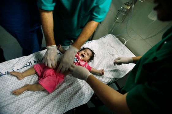 A Palestinian girl, who medics said was wounded in Israeli shelling, is treated at a hospital in Gaza City July 20, 2014.  (REUTERS/Suhaib Salem)